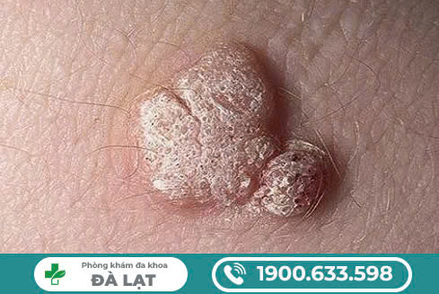 Hình ảnh minh họa